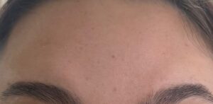 After Image: Wrinkle Relaxer