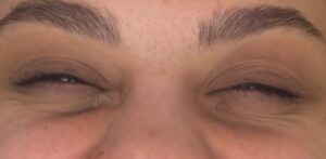 After Image: Wrinkle Relaxer