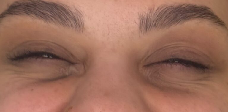 After Image: Wrinkle Relaxer - front