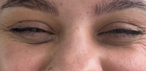 Before Image: Wrinkle Relaxer