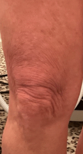 After Image: Morpheus 8