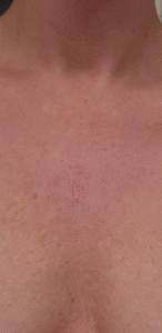 After Image: IPL Chest / Decelotte